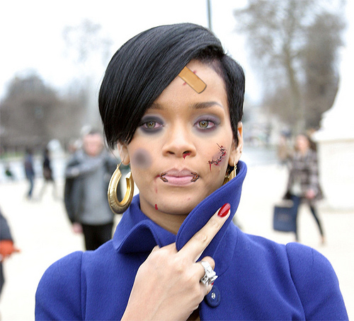 rihanna beaten up face. Rihanna…A Story of Degression