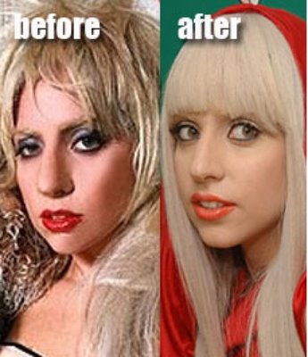 lady gaga before and after nose. Lady Gaga is being sued.